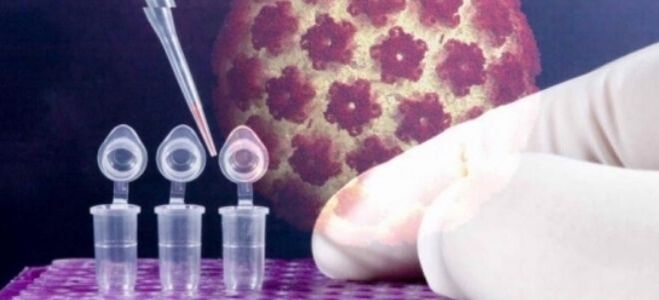 Diagnóstico del VPH mediante una prueba genética